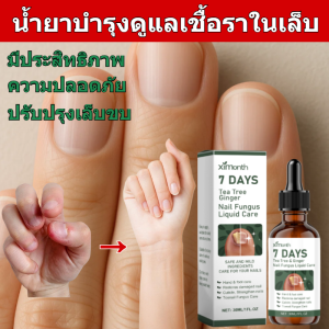 โซลูชั่นดูแลเล็บหนาขึ้นเพื่อปรับปรุงเล็บสีเทาและเล็บนุ่ม การดูแลเล็บ โซลูชั่นบํารุง โซลูชั่นเล็บสดใส