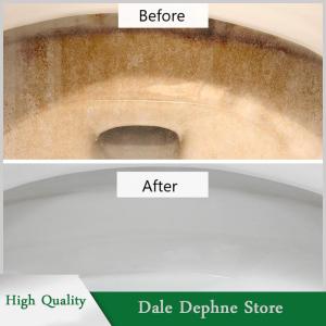 [Dale Dephne] Pumice đá nhà vệ sinh bàn chải phòng tắm WC nhà vệ sinh làm sạch bàn chải Wand gạch bồn rửa bồn tắm limescale Vết Loại bỏ rửa công cụ làm sạch