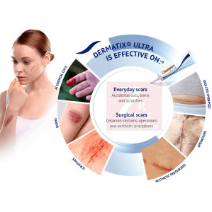 Dermatix Ultra Scar Gel 15g(To Reduce Surgical Scar)