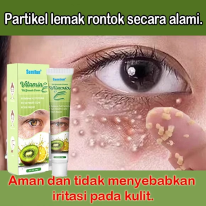 Kem Mắt Vitamin E Thiên Nhiên Đặc Biệt Cho Mắt Nhiều Mụn Thịt - Lành Tính Không Kích Ứng An Toàn Tuyệt Đối