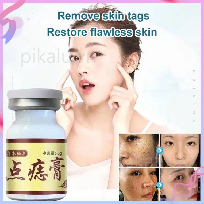 Seagril-concentrated Potent Skin Tag Removal Cream Concentrated Potent Skin Removal Cream Body Warts Cream Spot Mole