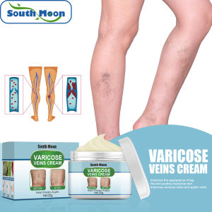 South Moon Natural Herbs Effective Varicose Veins Treatment Cream Spider Veins Cream Health Care Ointment Varicose Veins Cream Varicose Vein Removal Natural Treatment Spider Veins Cream Effective Original Varicose Veins Remover For Legs Veins Care
