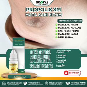 Obat Pemutih Mata Kaki Obat Mata Kaki Hitam dan Kasar Obat Sakit Mata Kaki Karena Gesekan Sepatu Obat Koreng Mata Kaki Obat Kulit Kaki Pecah-Pecah Obat Mata Kaki Hitam Kapalan Dengan Propolis SM