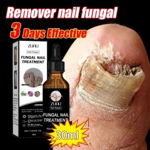 Nail Repair Essence Serum Original Serum Kuku Kuku Berjamur Dan Rusak