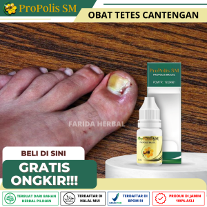 Obat Cantengan Jempol Kaki Kuku Rusak Bengkak Berdarah Bernanah Jamur Kuku Herbal Propolis SM