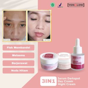 Yonglow Skincare Paket 3in1 Day Cream Siang Serum Darkspot Night Cream Krim Malam Resmi BPOM Formulasi dr Yong Serum Penghilang Flek Melasma Membandel Serum Penghilang Noda Hitam Pemutih Kulit Wajah Glowing
