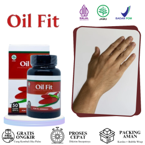 Obat Kista Ganglion Penghilang Benjolan Di Tangan Benjolan Di Pergelangan Tangan Benjolan Lemak Di Tangan Benjolan Lipoma Uci-Uci Kelenjar Getah Bening Herbal Benjolan Di Tangan Dengan Oil Fit