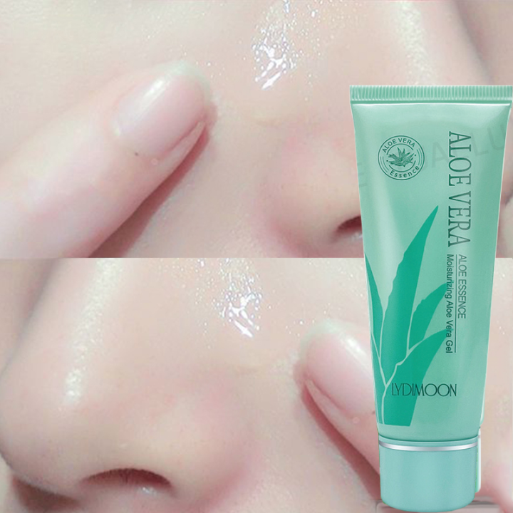 Moisturizing skin care products Aloe Vera Gel Chilling Aloe Vera Gel  After-sun Repair Cream Fades acne marks Moisturizing and moisturizing  Gentle and non-irritating Improve rough skin Unisex | Lazada
