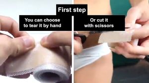 Silicone Medical Scar Patch Gentle Pregnancy Surgery Silicone Scar Tape Gel Removal Patches Sheet