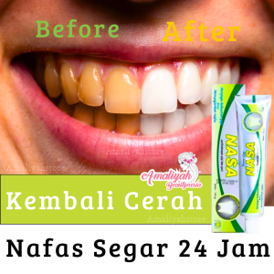 Odol Nasa Pasta Gigi Obat Alat Perontok Pembersih Plak Karang Gigi Kuning Berlubang Putih Permanen