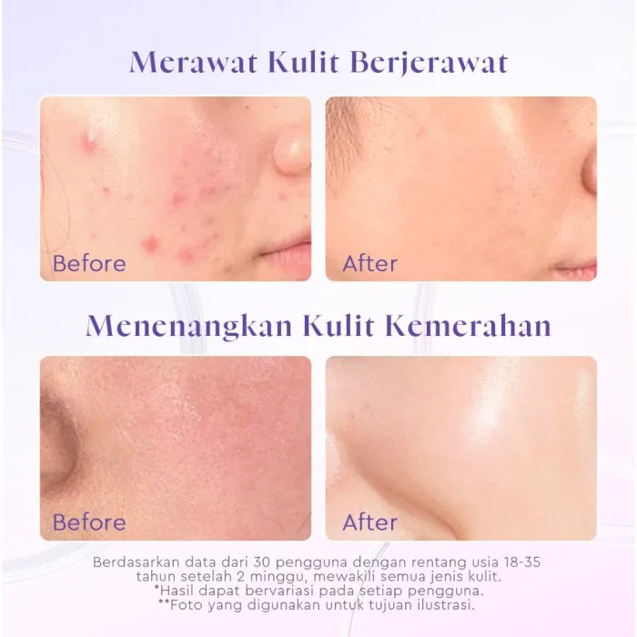 Glad2Glow%20Blueberry%20Ceramide%20Low%20pH%20Gel%20Cleanser%20-%20Image%203