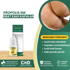 Obat Telapak Kaki Kapalan Obat Kulit Kaki Menebal Obat Kapalan Rorombeheun Obat Kulit Keras Obat Kaki Pecah Dan Kering Obat Kaki Kapalan Retak Retak Proriasis Berjamur Obat Tumit Pecah Pecah - PROPOLIS SM