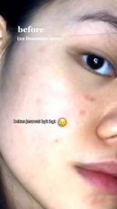 LCANTIFLEK LACOCO NASA ORIGINAL