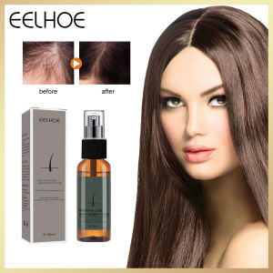 Eelhoe Loss Hair Growth Fluid Hair Loss Treatment For Women Hair Growth Faster Hair Treatment For Hair Loss Hair Loss Treatment Serum Hair Care Essential Oil Hair Growth Essence Hair Loss Treatment Fluid Hair Growth Ginger Essence Spray（30ml）