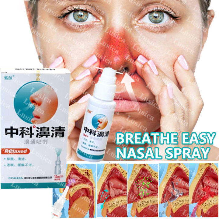 100% ORIGINAL Nasal Comfort Nasal Spray Sinusitis Spray Chronic Rhinitis Rhinitis Allergic Rhinitis Nasal Care Chinese Medicine Spray Rhinitis Treatment Safe Herbal Spray Treatment Rhinitis and Nasal Congestion Spray 20ml