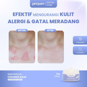 PREPARE Melembapkan Kulit Kering Mengatasi Psoriasis Serta Eczema Dengan Ceramide Balm BPOM