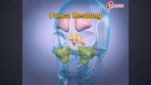 1 BOTOL EK SINES UBAT RESDUNG SINUS ORIGINALMild and effective