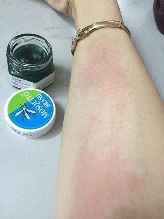 kem%20b%C3%B4i%20mu%E1%BB%97i%20Th%C3%A1i%20lan%20-%20Image%201