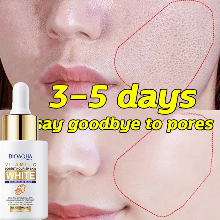 Vitamin C Serum Whitening Facial Essence Melasma serum Remover