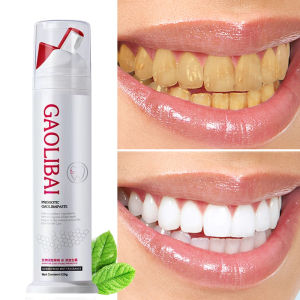Gaolibai pasta gigi Pemutih gigi Memutihkan Gigi Kuning Penghilang Karang Gigi Dan Pemutih Gigi Permanen Odol Pembersih Karang Gigi