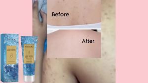 🤝 Family Trusted OUHOE  Cooling Moisturizing Cream   Improve Dryness Hydrating Moisturizing Deep Nourishing Relief After Sunburn Sun Damage Body Lotion
