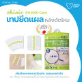 Skinix Atless Care เทปยึดแผลหลังตัดไหม ฟิล์มยึดแผล ป้องกันแผลปริแยก ฟิล์มปิดแผลกันน้ำ ลดรอยแผลคีลอยด์ แผลนูน ลดรอยแผลผ่าตัด [Exp. 12/05/25]. 