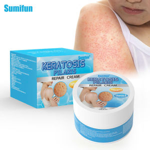 Kem Dưỡng Ẩm Làm Mềm Da Toàn Thân Chứa Urea 10% Và Vitamin E Giúp Làm Mịn Da Sần Sùi Dưỡng Trắng Da Khô Hiệu Quả