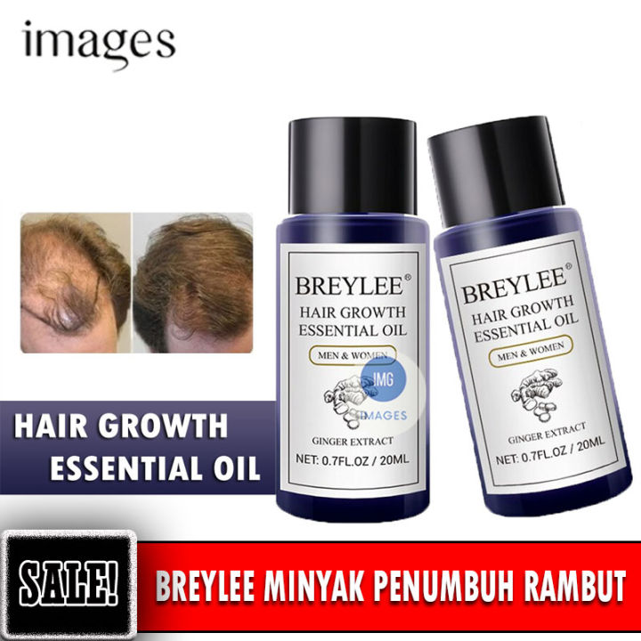 Breylee Hair Growth Essential Oil - Serum Penumbuh Rambut Dalam 2Hari Menumbuhkan dan Mencegah Rambut Rontok Patah Bercabang - Obat Penumbuh Rambut Botak - Penumbuh Rambut Cepat - Perawatan Rambut Rontok dan Kusut - 20mL