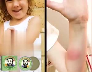 South Moon Krim Perbaikan Lithospermum Mencegah gigitan nyamuk dan gatal pada kulit untuk bayi dan anak-anak krim perawatan pengusir nyamuk