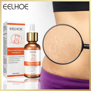 Eelhoe Stretch Mark Repairing Essential Oil Maternity Cream Stretch Marks Remove For Women Treatment Skin Care Maternity Pregnancy Scars Body Cream Stretch Marks Removal Of Scar Cream Slack Line Firming Lifting Skin Stretch Mark Repair Cream