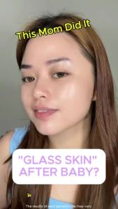 SEYOUL 21 DAYS SERUM  Melasma Freckles Large pores Helps the skin become bright and healthy