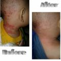 Beeme Nourishing Balm | SKINCARE IBU DAN ANAK. 