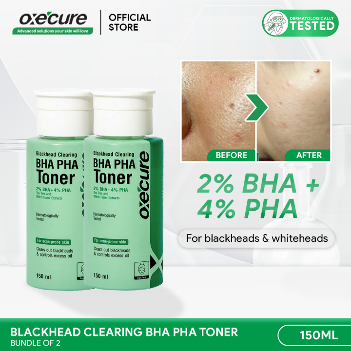 OXECURE Blackhead Clearing BHA PHA Toner 150ml Bundle of 2