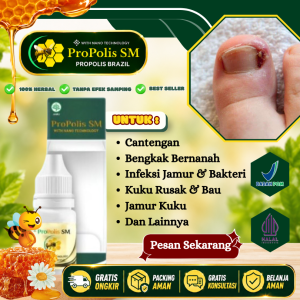 Obat Kuku Cantengan Infeksi Jamur Bakteri Cantengan Bau Busuk Bernanah Sakit Bengkak Kuku Rusak Menghitam Perawatan Tetes Jempol Kaki Cantengan - Propolis SM PALING AMPUH NAMUN SETIAP ORANG HASILNYA BERBEDA
