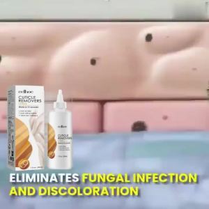 【Instant Cuticle Care Gel】Nail Fungus Savior! Fast Relief for Soft/Brittle/Discolored Nails｜Deep Moisturizing Serum｜Herbal Penetration｜Banish Yellowing & Thickening｜Long-Lasting Hydration｜Healthy & Shiny Nails