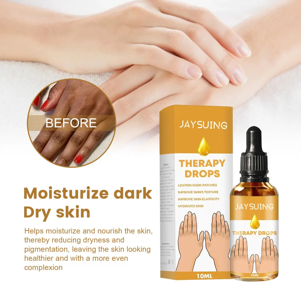 Jaysuing Therapy Drops Skin Therapy Oil Acanthosis Nigricans Spot