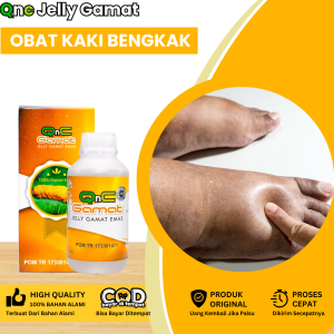 Obat Edema Kaki Bengkak Obat Bengkak Pada Kaki Obat Kaki Bengkak Diabetes Obat Kaki Bengkak Dan Nyeri Obat Kaki Bengkak Akibat Pembekuan Darah Obat Pergelangan Kaki Bengkak Dengan Qnc Jelly Gamat