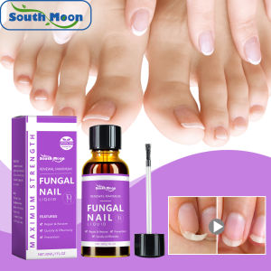 South Moon Nail Strengthening Oil Nail Fungus Treatment Repairing Paronychia Ingrown Toenail Onychomycosis Removal Care Fungal Nail Treatment Serum Nails Fungus Removal Treating Paronychia Liquid Anti Gray Nails Toe Infection Foot Repair Care Tools