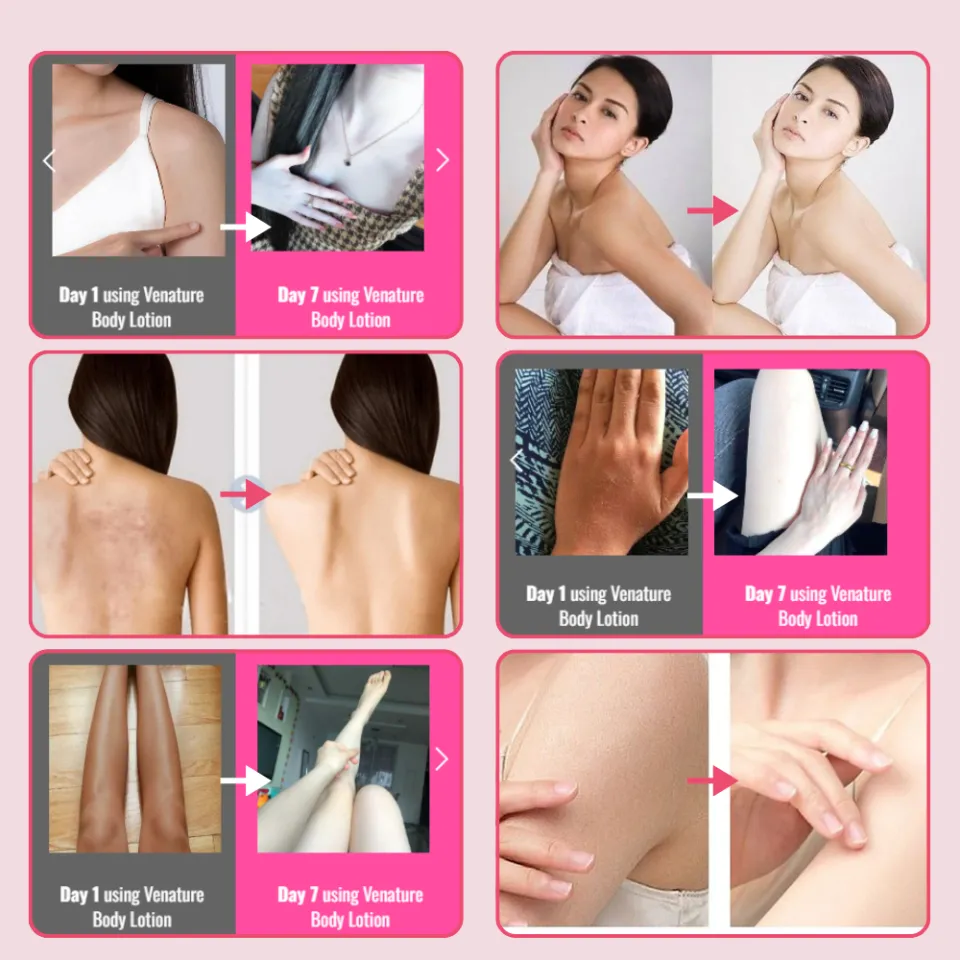 venature glutathione 50x body lotion reviews Amazon.com : Glutathione 50x Tone Up Body Lotion, 2 Pack Moisturizing,  Hydration and Nourishing, Soft Skin All Over Body Scented Body Lotion for  Women (2 Packs) : Beauty & Personal Care main image 1