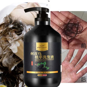 👍Anti Hair Loss Shampoo Repair Damaged Hair Preventing Hair Fall shampoo rambut gugur Care Liquid Denser Hair Shampoo Hair Growth Shampoo to wash hair anti dandruff shampoo hair loss shampoo