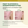 [ AHA NIACINAMIDE SERUM EXTRA STRENGTH  ] Greenika Nia-X 2% Extra Strength AHA Face Whitening Serum with Glycolic Acid & Niacinamide Moisturizer Anti Acne Dark Spot Remover Facial Serum Body Serum Vitamin C E Serum Moisturizer for face. 