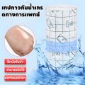 ForestM เมมเบรน PU กันน้ำ ครอบคลุมทางการแพทย์ ฟิล์มกาว PU ทางการแพทย์, ป้องกันอาการแพ้, เทปตกแต่งบาดแผล. 