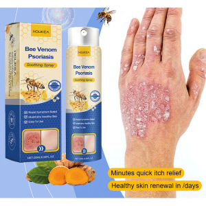 Psoriasis Treatment Spray Gentle and Delicate Skin Topical Spray