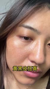 New product Zuoxiang Skin Research Whitening and Freckle Removal Cream Moisturizing brightening silky smooth refreshing non-greasy spot-reducing face cream wholesale