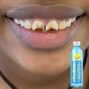 Jaysuing Mouthwash Removes Dental Dirt Eliminates Bad Breath Refreshes Oral Care Mouthwash