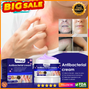 ORIGINAL South Moon Anti Bacterial Eczema Cream Anti Itching Sweat Herpes Treatment Psoriasis Cream Herbal Antibacterial Agent Anti-itch Relief Eczema 30G Skin Rash Kati Kati sa Balat at IBA PA