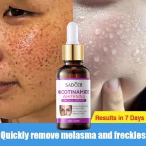 SADOER Effective Freckle Cream Serum Remove Dark Spots Witening Serum Fade Acne Scars Melasma Anti-Aging Skin Lightening 30ML-Serum pemutih-wajah glowing krim-cream penghilang flek -wajah cream siang malam -cream wajah glowing