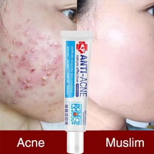 Krim Penghilang Jerawat Herbal Krim Penghilang Jerawat Krim Perawatan Kulit Pemutih Gel Wajah Pelembap Kontrol Minyak Jerawat 25G