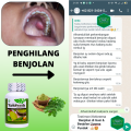 Obat Kanker Mulut, Obat Mengobati Kanker Mulut Dan Tenggorokan, Nyeri Kangker Jinak Stadium Awal, Suplemen Pengempis Benjolan Lunak Kerasa Pada Mulut, Lidah, Gusi Atas Bawah, Kista Daging Jadi Keras, Penghancur Tumor Mulut Stadium 1 2 3 - Keloreena Alami. 