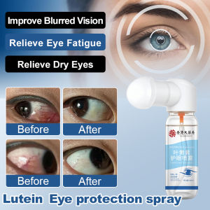👁️Lutein Eye Spray Relieves Eye Fatigue Dryness Blurred Vision and Cleanses the Eye Care Solution叶黄素护眼喷雾